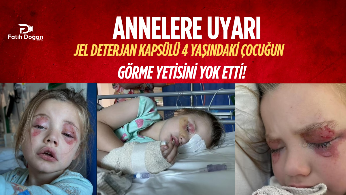 Annelere Uyarı: Jel Deterjan Kapsülü 4 Yaşındaki Çocuğun Görme Yetisini Yok Etti!