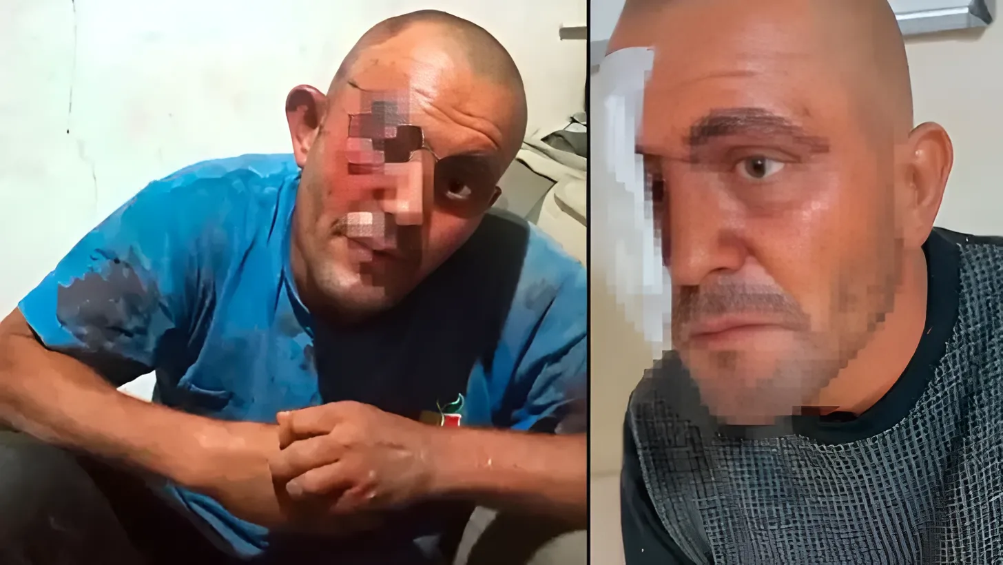 Ceyhan’da Selçuk Demir Darbedildi: Üç Şüpheli Aranıyor